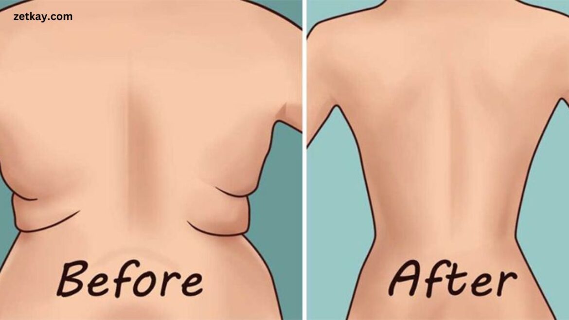 How To Get Ride Of Back Fat