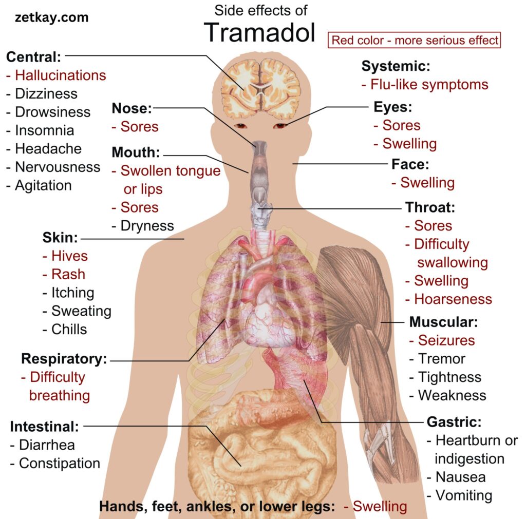 Tramadol