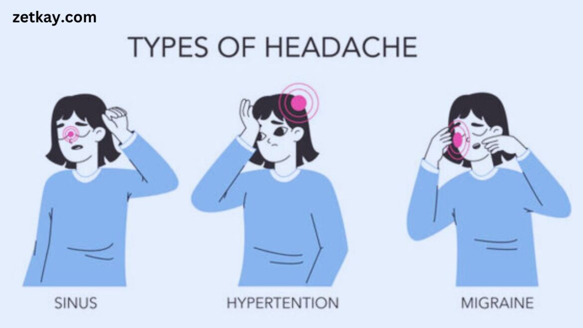 Types of Headaches