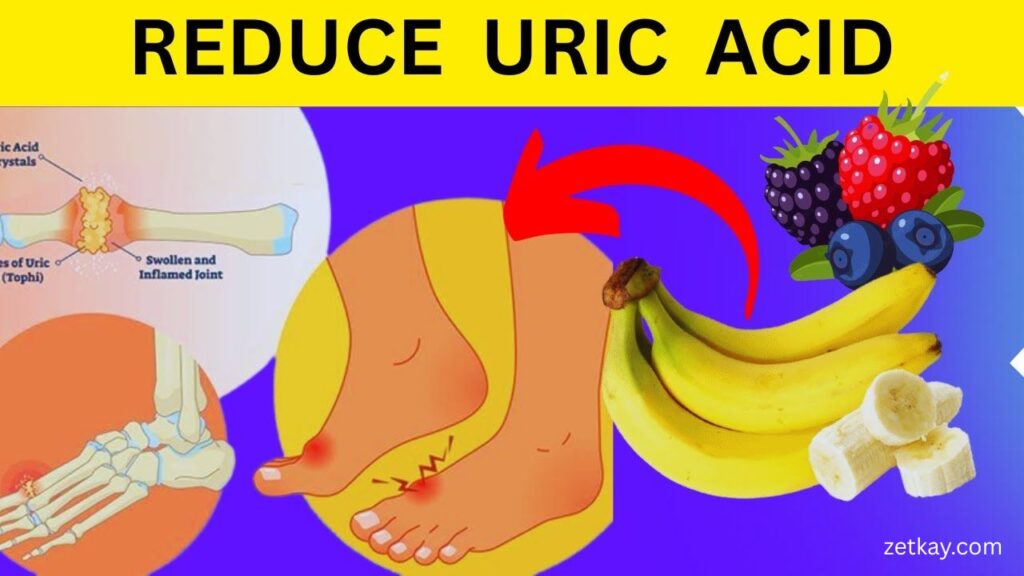 Uric Acid
