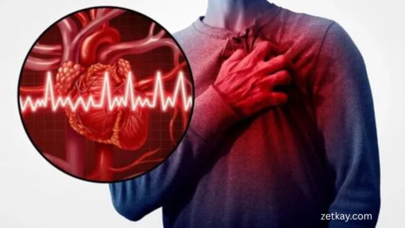 Heart Attack