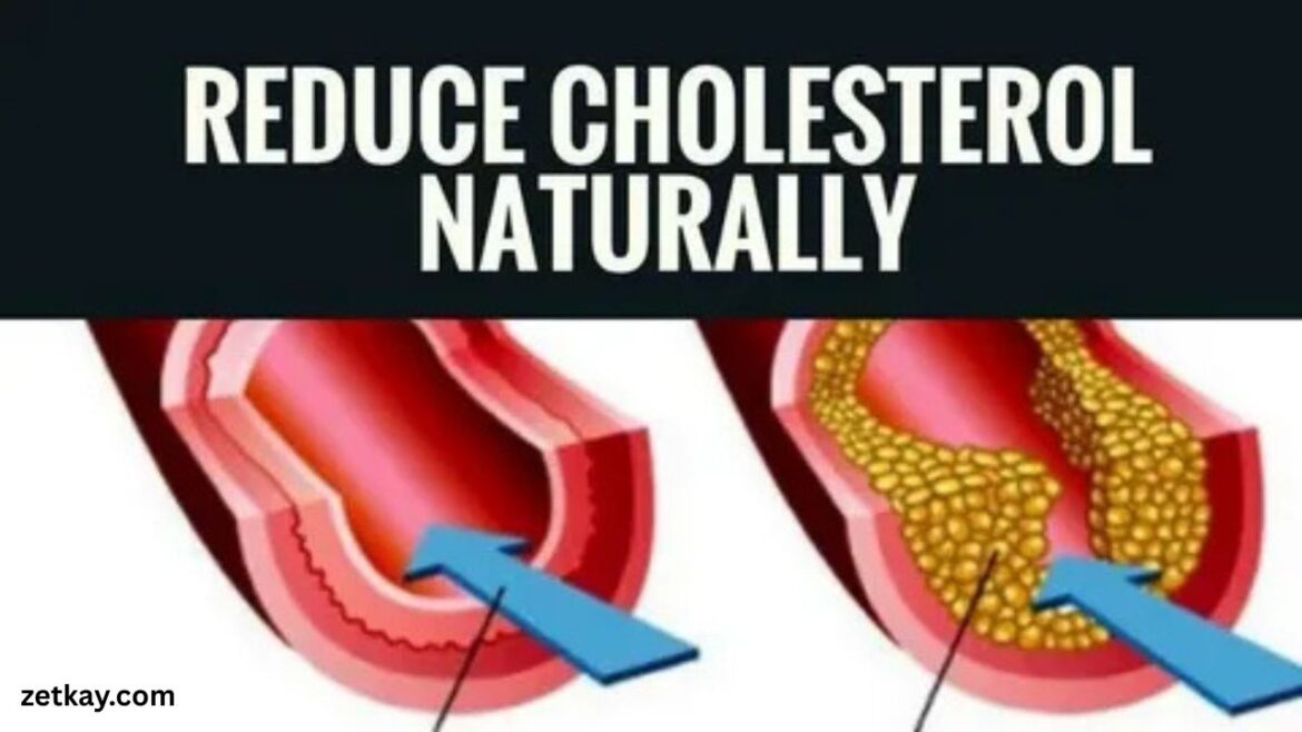 Cholesterol